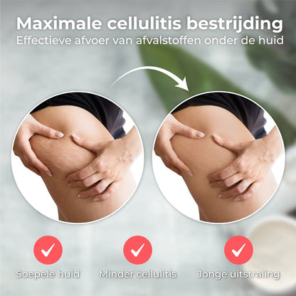 Elektrische Cupper - Massage Apparaat